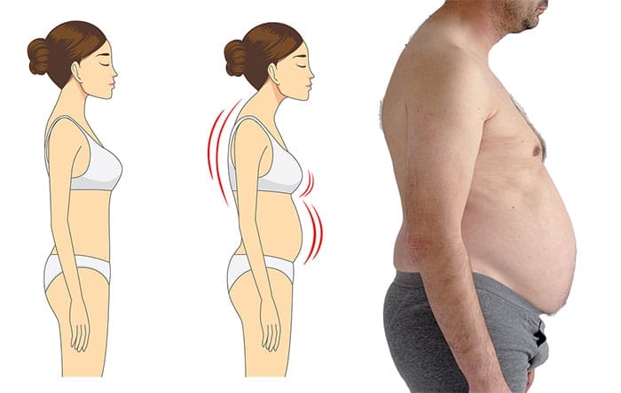Slouching causes belly fat