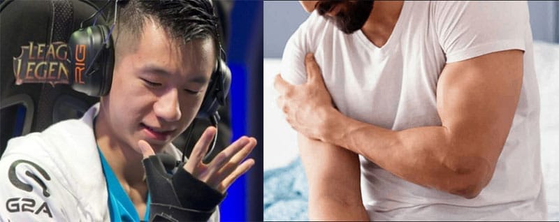 Pro esports player injuries