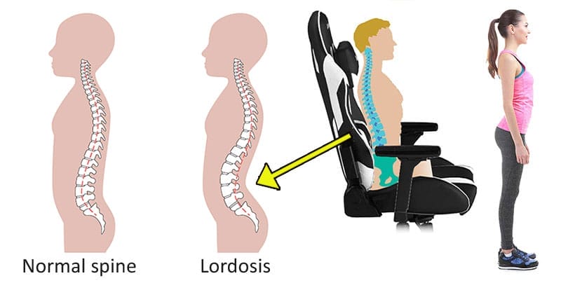Lordotic sitting in an ergonomic chair