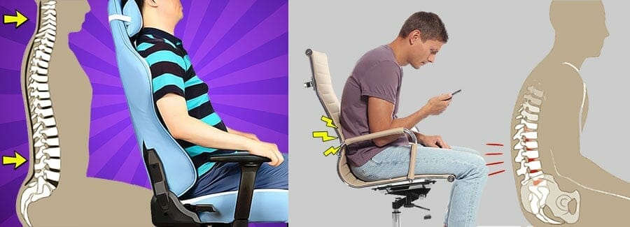 Spinal problems caused by slouching