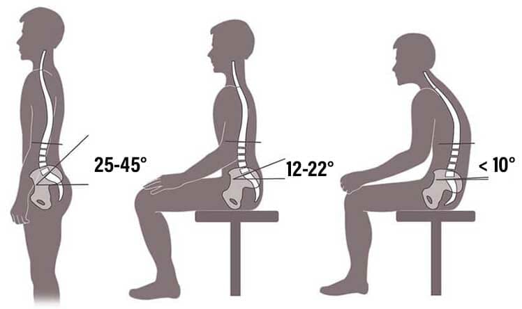Nautral curves in the lumbar spine
