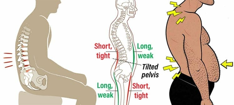 Body distortion caused by sloppy sitting habits