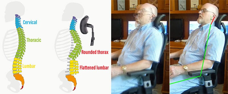 Staples Hyken headrest misuse