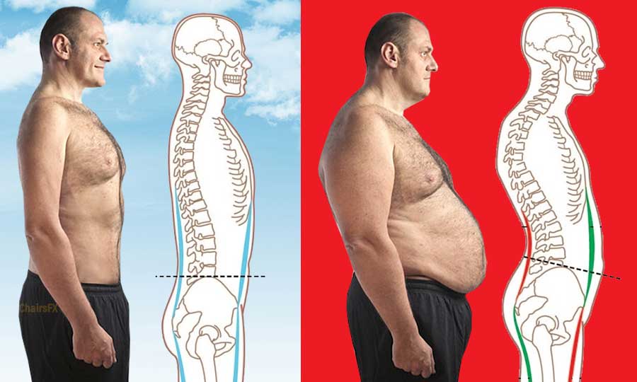 Musculoskeletal Disorders suffered by desk workers