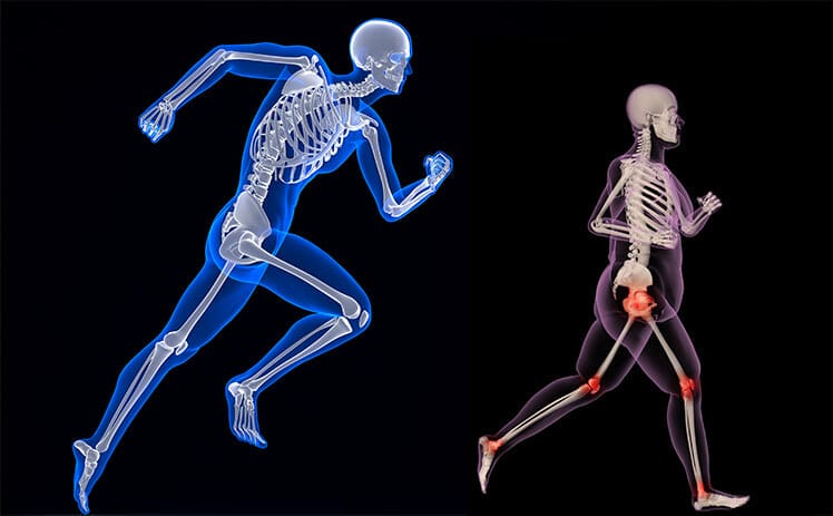 Tall vs fat skeletal structures