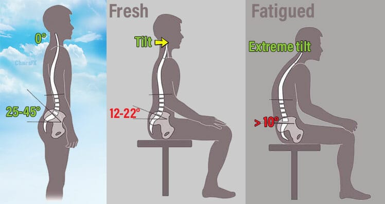 Why sitting is bad for you