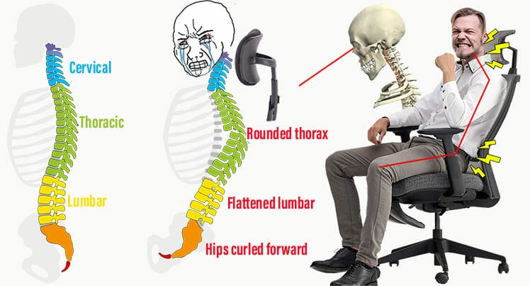 How a headrest distorts good posture