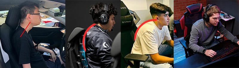 Pro esports players with poor posture