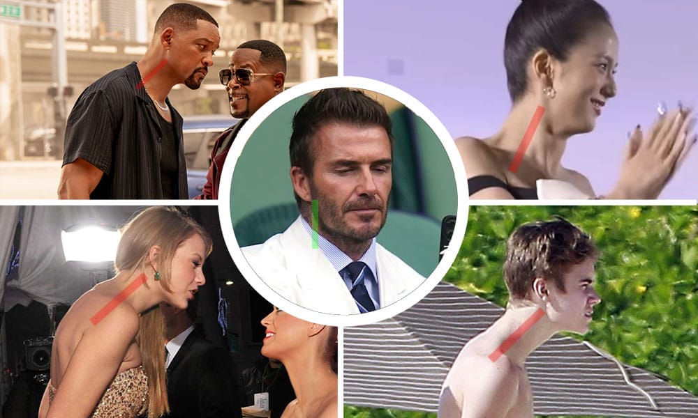 Celebrities with forward head posture feature