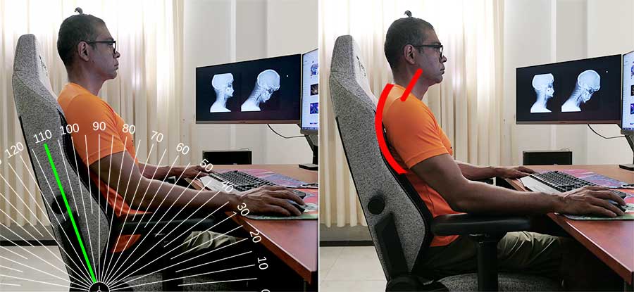 Side-by-side comparison of man sitting in gaming chair at desk: left image shows measurement overlay with backrest recline angles ranging from 0° to 135°, right image highlights rounded upper back posture with red overlay showing thoracic kyphosis during deep recline position while computing