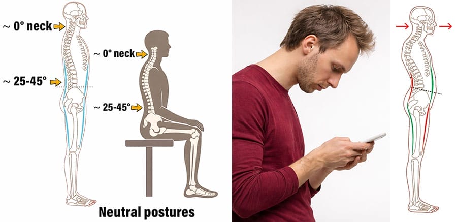 Comparison image showing neutral standing and sitting postures with near-0° neck alignment versus a man using a smartphone with a forward-tilted head, illustrating how text neck changes spinal curves along the entire spine.